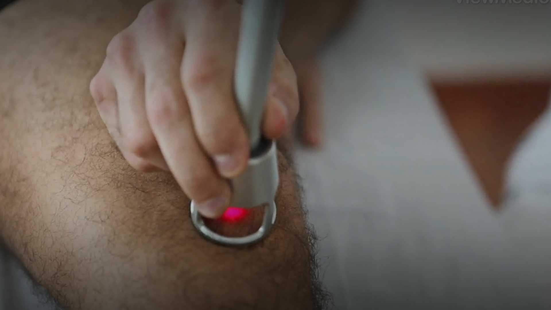 Cold Laser Therapy at San Ramon Auto Accident Injury Clinic in San Ramon